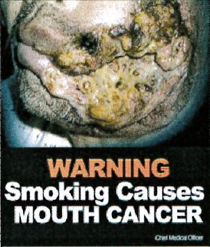 Jamaica 2013 Health Effect mouth - mouth cancer, gross, lived experience (front)